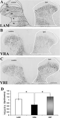 Plasticity of Select Primary Afferent Projections to the Dorsal Horn after a Lumbosacral Ventral Root Avulsion Injury and Root Replantation in Rats